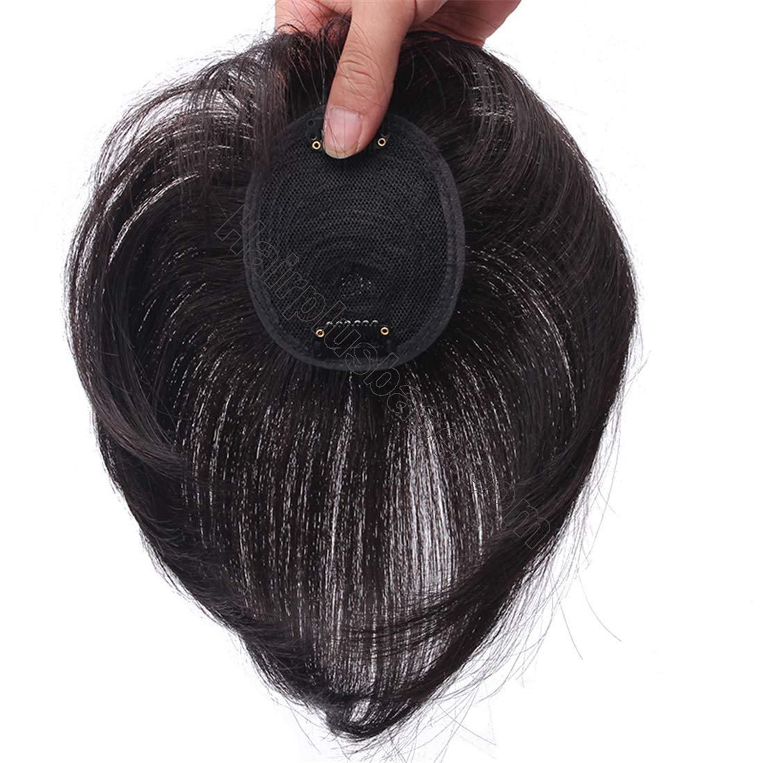 crown hair loss