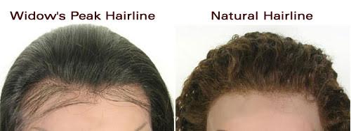hairline